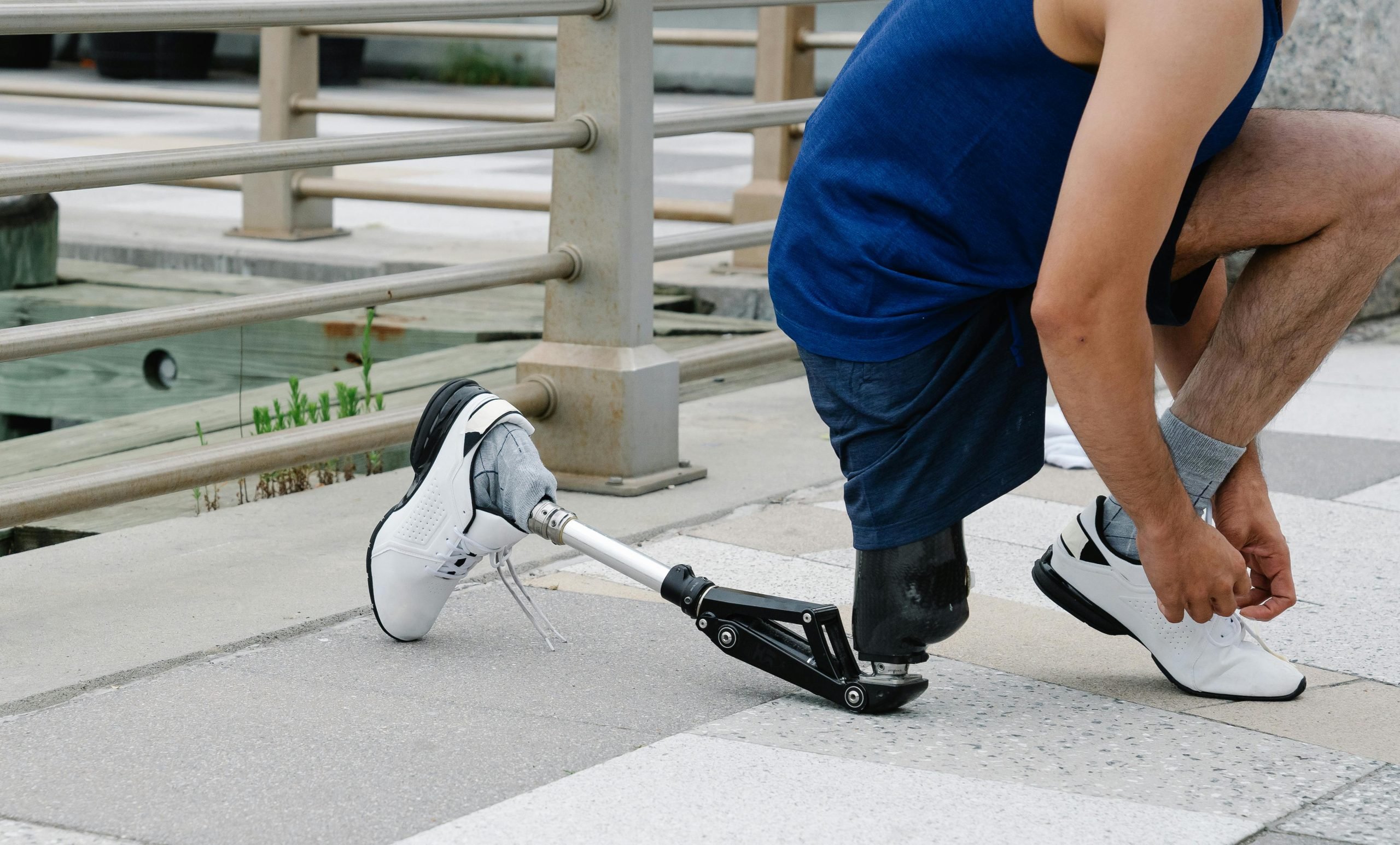 New Prosthetic Interface Lets Amputees Control Limbs with Their Minds