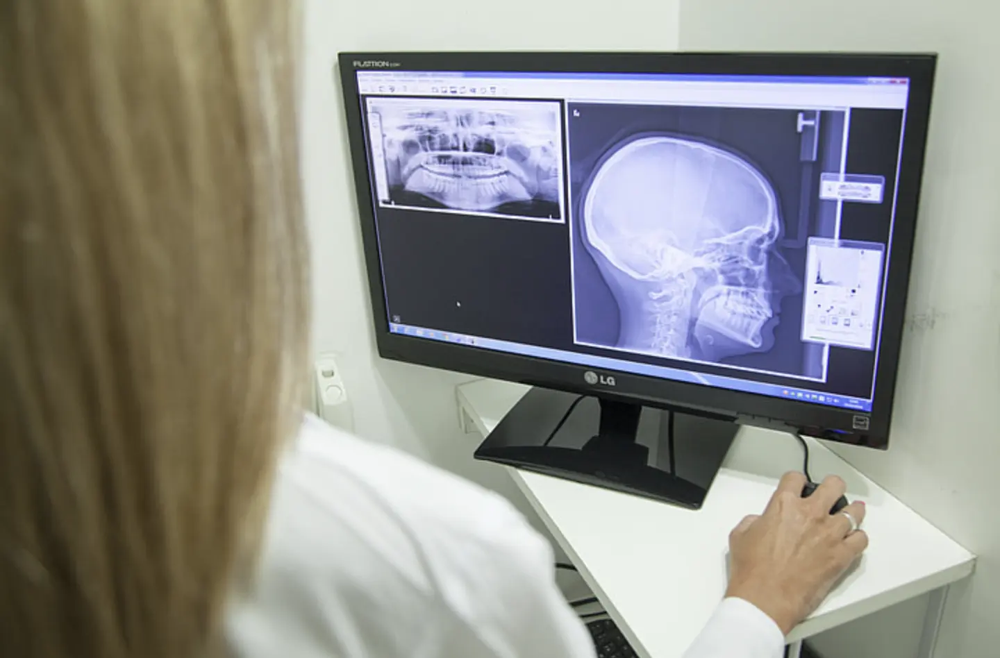 AI Tool Speeds Up Medical Image Analysis