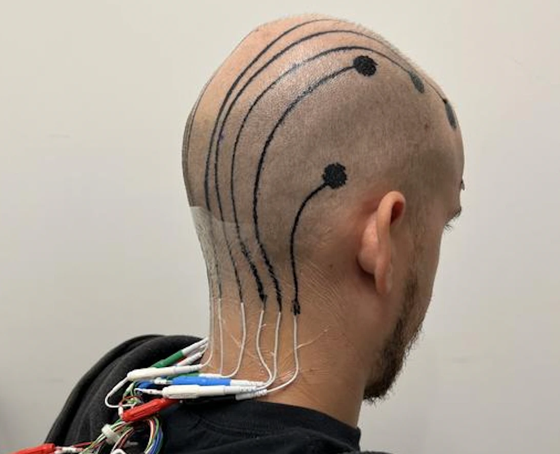 New E-Tattoos To Replace Traditional EEG Systems