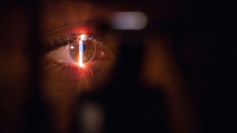 Gaming’s Bot Problem: Would You Scan Your Eye to Prove You’re Human?